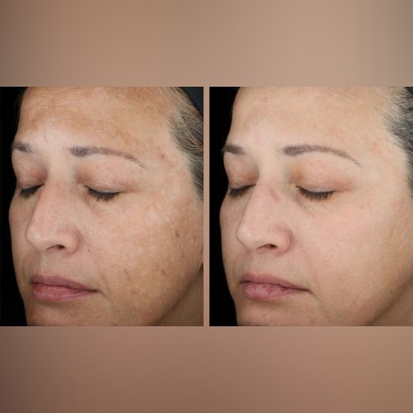 SkinMedica TNS Recovery Complex New in Box 1 Oz - Picture 2 of 2